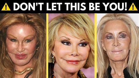 Worst Celebrities Before And After Plastic Surgery