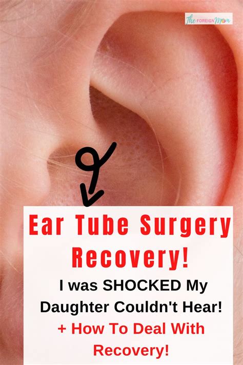 Ear Tube Surgery Recovery! in 2020 | Ear tubes, Surgery recovery, Surgery