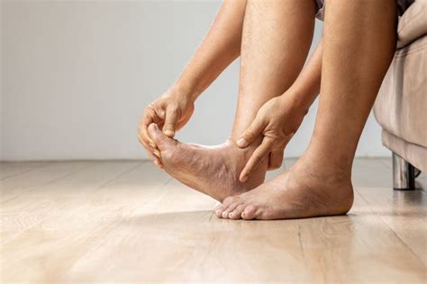 Edema: Types, Symptoms, Causes, Treatment, & More