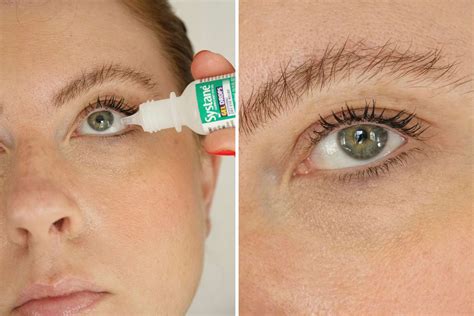 The 13 Best Eye Drops for Dry Eyes of 2024, According to an Ophthalmologist