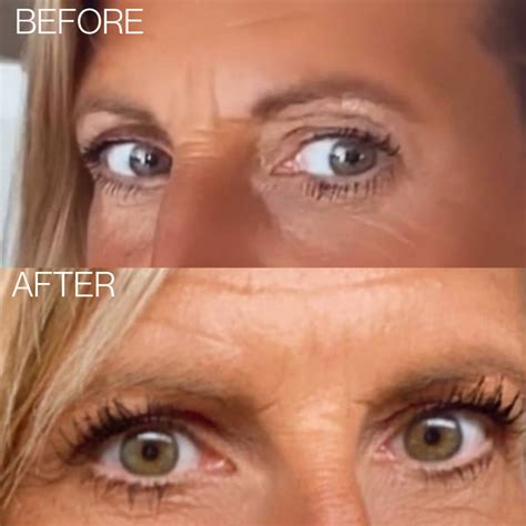 EYELASH ENHANCING SERUM - BEAUTICAL