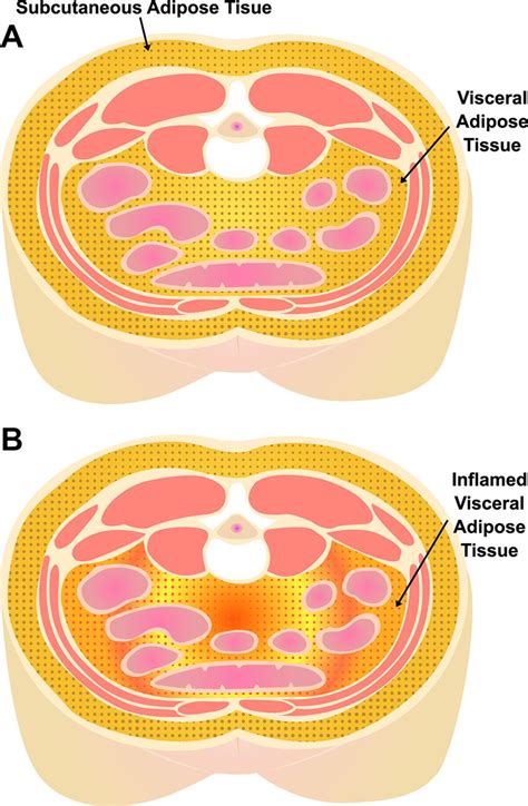 Visceral (VAT) and subcutaneous (SAT) adipose tissue depots. (A ...