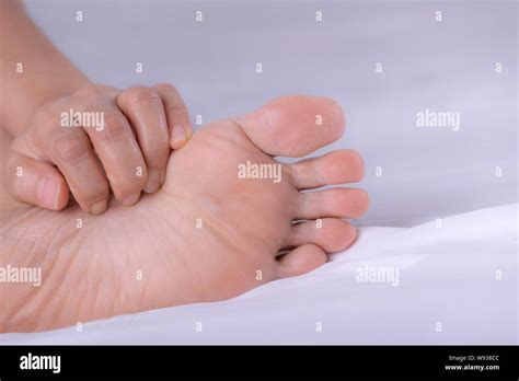 Female with rash or papule and scratch on her foot from allergies ...