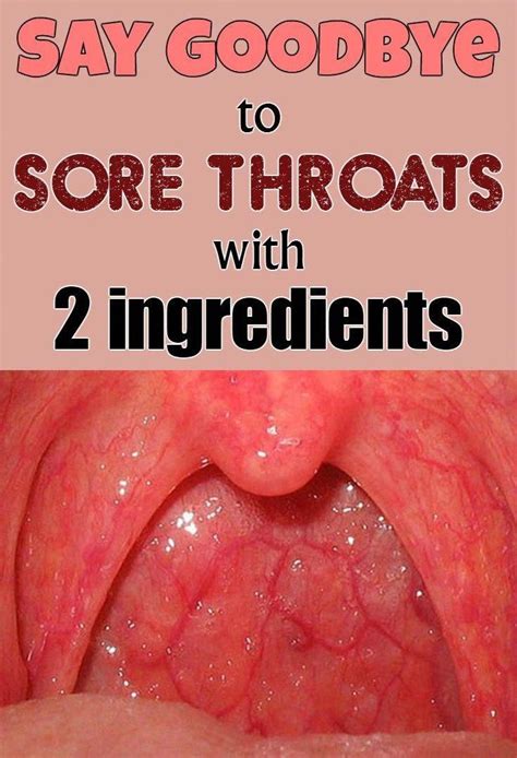 Home Remedies to counter Throat, Skin,Eye,Sinus Infections in 2020 ...