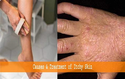 What causes itchy skin in the elderly?