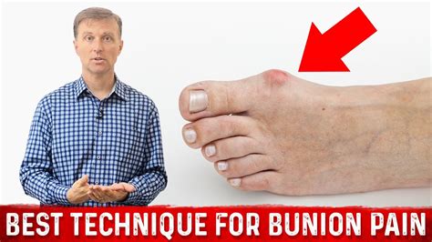 Bunion Pain Relief – The Simple & Best Technique by Dr.Berg - YouTube