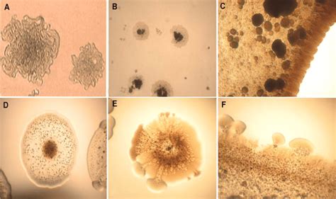 Mycobacterium Tuberculosis Colony Morphology