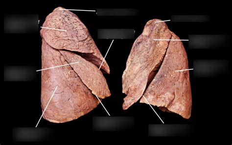 Lung Anatomy Posterior