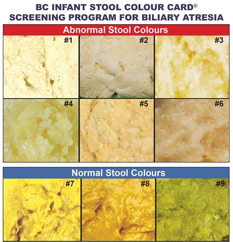 Bile Color Chart