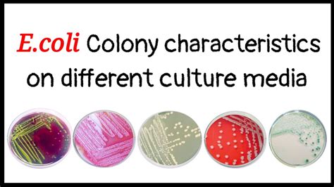 Escherichia Coli Colony Morphology