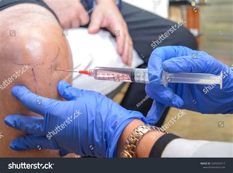 Stem Cell Injection Into Right Knee Stock Photo (Edit Now) 1635544717