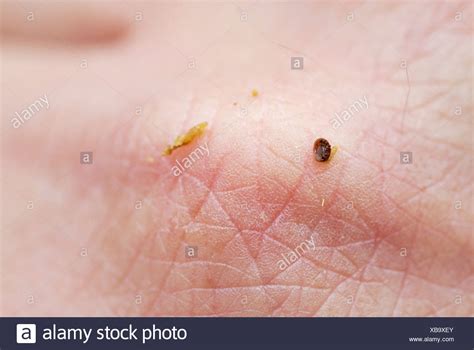 Varroa Destructor Varroa Mite Stock Photos & Varroa Destructor Varroa ...