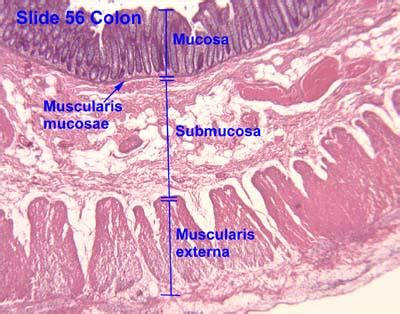 Pathology Outlines - Histology