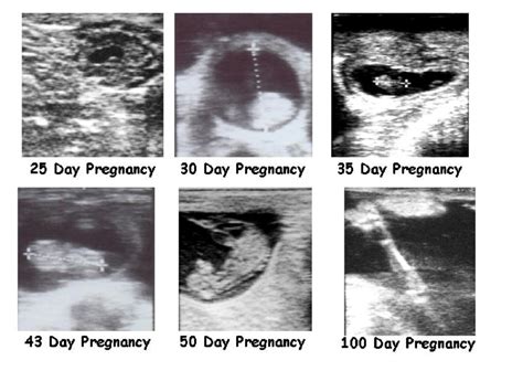 Ultrasound images of the bovine fetus at various stages of development ...