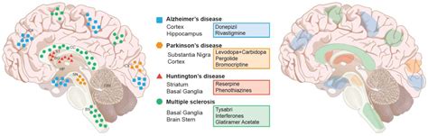 Is Ms A Neurodegenerative Disease - Quotes Trending