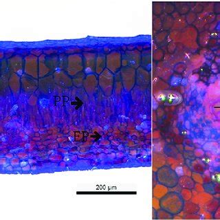 Seedling sections of the R. mangle leaf. H: Hypodermis thickness; LT ...