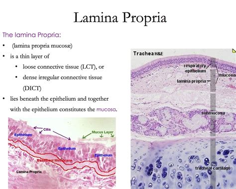 Lamina Propria - Histology | Loose connective tissue, Histology slides ...