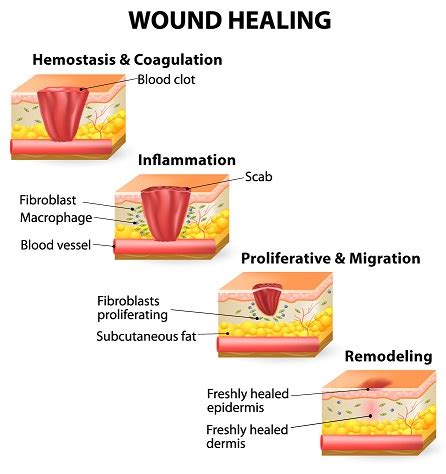 Wound Healing Process