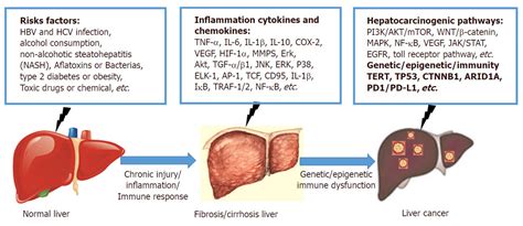 Difference Between Liver Cancer And Liver Cirrhosis - CancerWalls