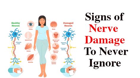 Signs of Nerve Damage to Never Ignore - WomenWorking