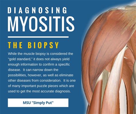 Myositis - Expose Forum Photo Galery