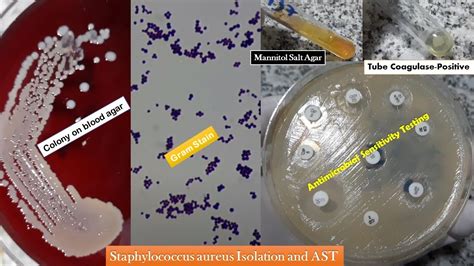 Gram Stain Staphylococcus Aureus