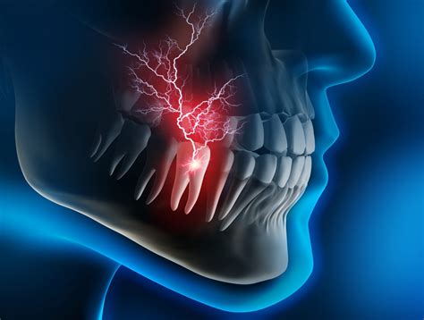 Different Types of Tooth Pain and What They Mean