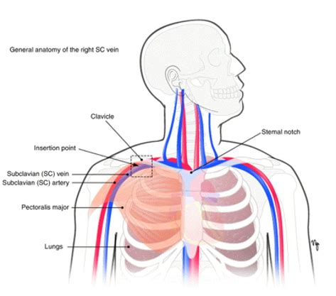 Procedural Ultrasound: Subclavian Access & Confirmation