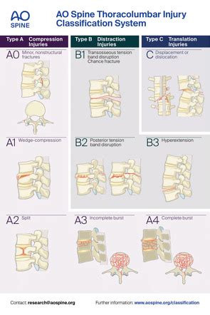 Ao Classification Spine Trauma