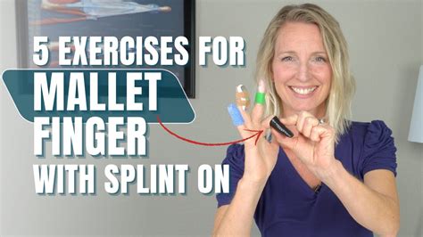 Best 5 Exercises with a Mallet Finger Splint On: What To Do While Your ...