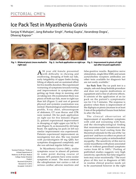 (PDF) Ice pack test in myasthenia gravis