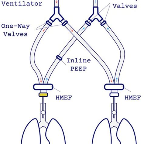 Applying intrinsic PEEP and measurement of the total PEEP to determine ...