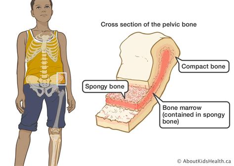 Bone Marrow Aspirate Concentrate (BMAC)