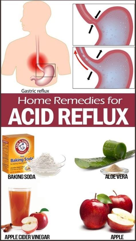 Some useful remedies for you to cut down on acid reflux