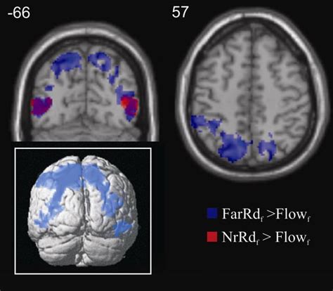 Activation in superior parietal lobe, inferior parietal sulcus and ...