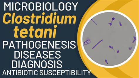 Clostridium tetani pathogenesis | Clostridium tetani microbiology | lab ...