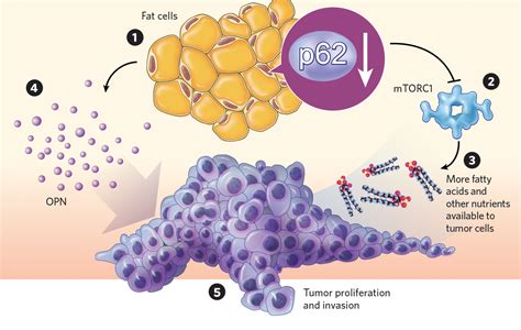 Infographic: How Fat Cells Influence Tumor Growth | The Scientist Magazine®