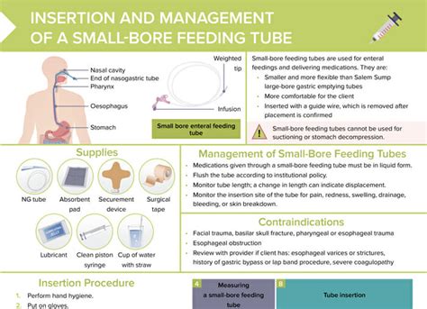 Nasogastric Tube Placement Knowledge AMBOSS, 51% OFF