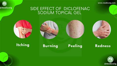 What Is Diclofenac Sodium Topical Gel Used For?