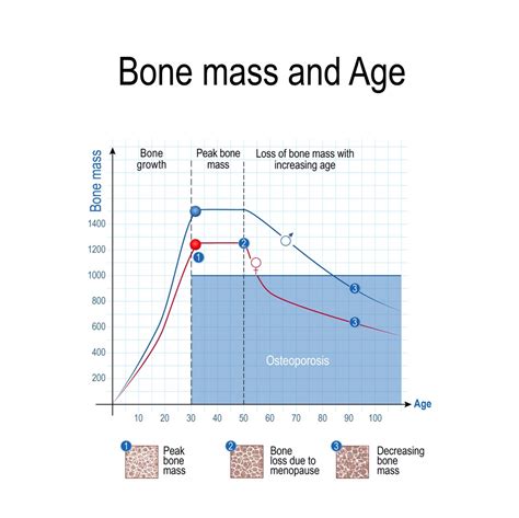 Female Bone Density Chart By Age