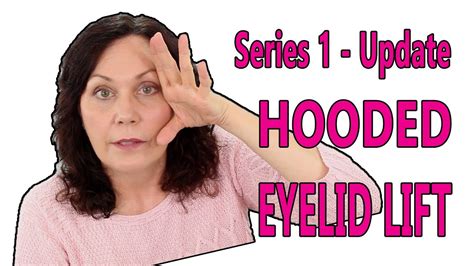 Droopy Eyelid Remedy - Facerobics Facial Exercises - YouTube