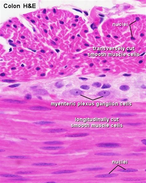 File:Smooth muscle histology 002.jpg - Embryology