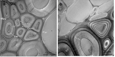 Ultrastructure and Topochemistry of Plant Cell Wall by Transmission ...