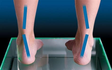 Understanding Pronation and Supination: Key Differences Explained