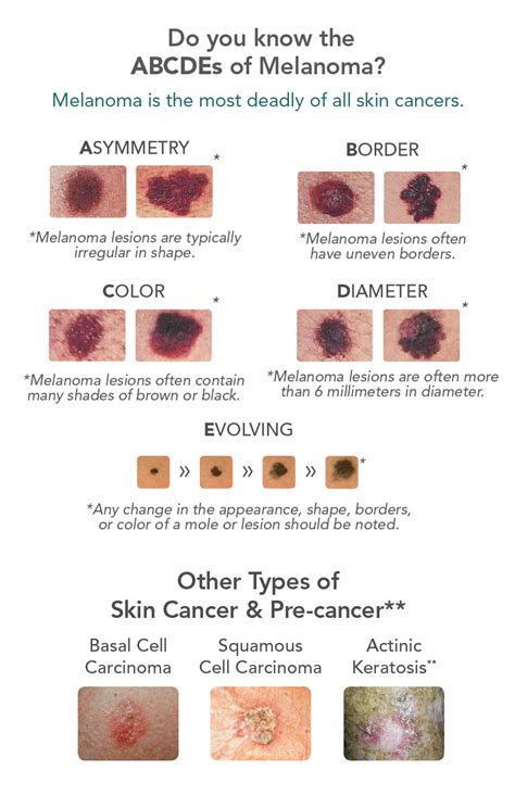 Skin Cancer Warning Signs | Associates In Dermatology