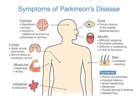 FAQS on Parkinson's Disease - HOSIPED