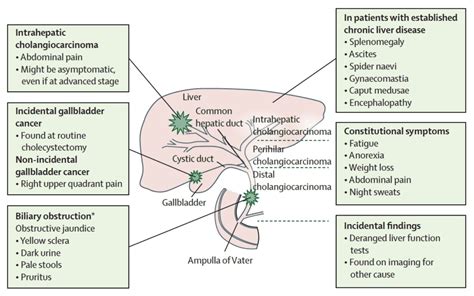 Symptoms - Cholangiocarcinoma Australia