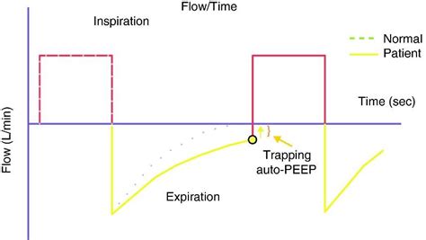 Measurement of AutoPEEP and total PEEP | Hamilton Medical