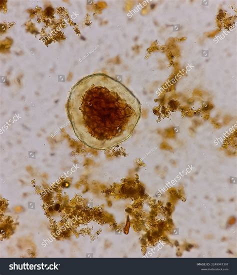 Giardia Lamblia 400x