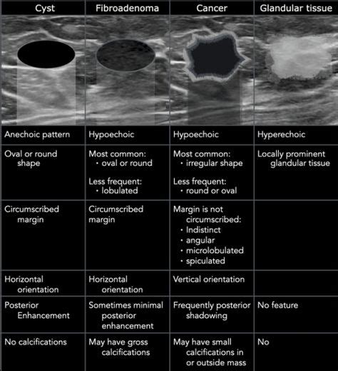 19 Radiology Ti-RADS ideas in 2021 | radiology, sonography, ultrasound